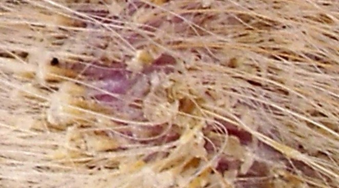 Detail - seborrhea