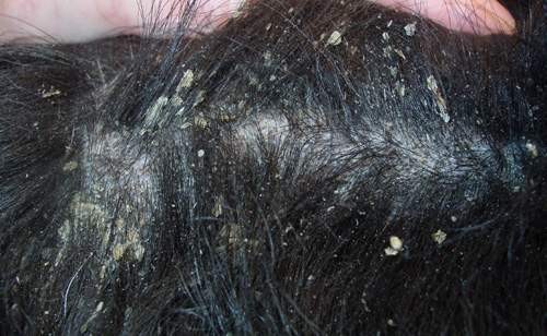 Dermatitida na psí kůži